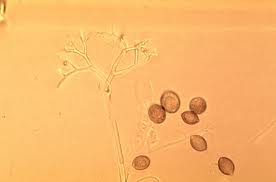 diseases_25